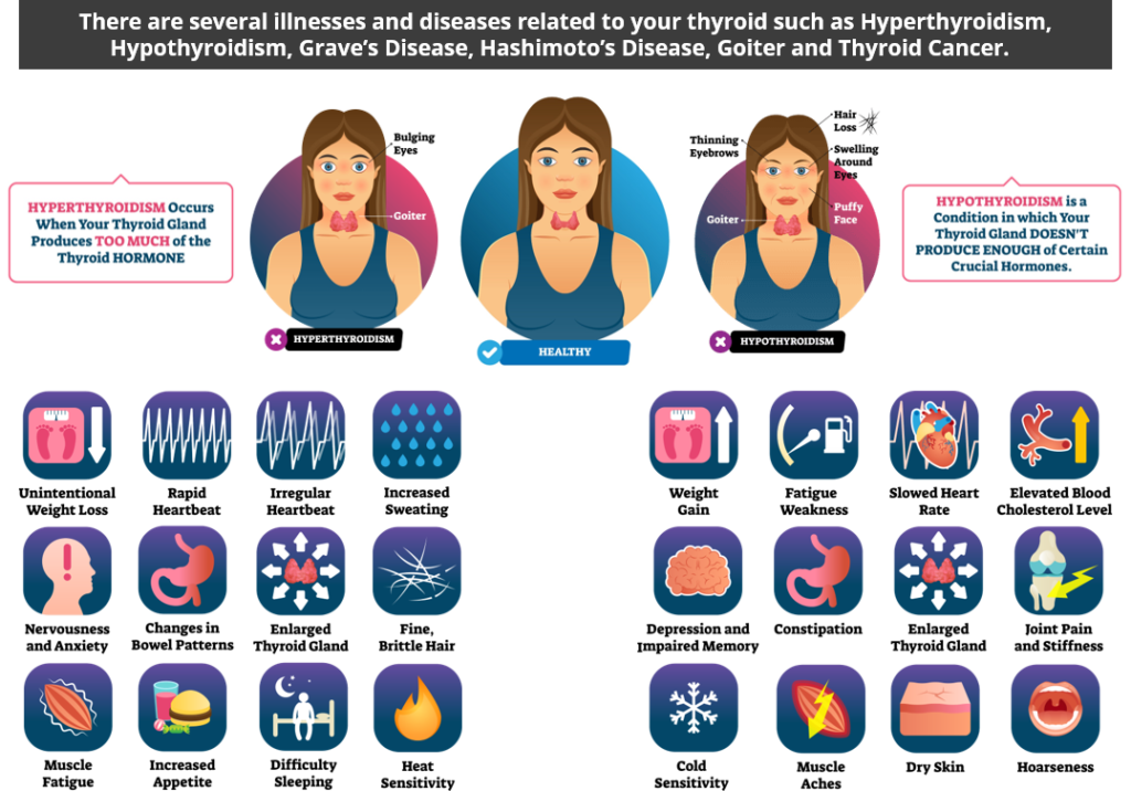 The Ultimate Thyroid Guide - Default Landing Page - Strategic Services Group - HyperHypThyroidism_Graphic-1024x716