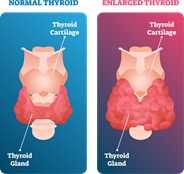 The Ultimate Thyroid Guide - Default Landing Page - Strategic Services Group - image
